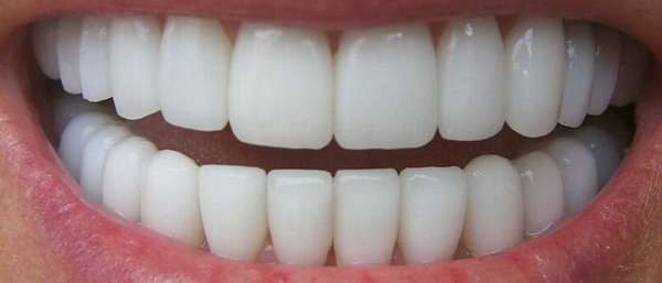Зубы при ревматоидном артрите